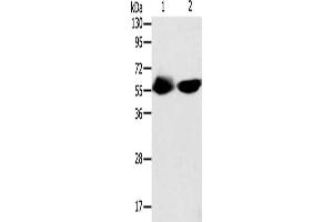 Gel: 10 % SDS-PAGE, Lysate: 40 μg, Lane 1-2: Human fetal muscle tissue, Lncap cells, Primary antibody: ABIN7131319(TEKT3 Antibody) at dilution 1/550, Secondary antibody: Goat anti rabbit IgG at 1/8000 dilution, Exposure time: 30 minutes (Tektin 3 antibody)