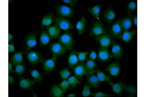 Immunofluorescence staining of A549 cells with ABIN7156973 at 1:133, counter-stained with DAPI.