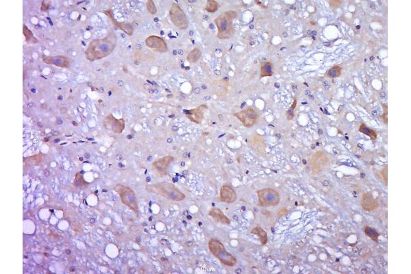 OGFOD2 antibody  (AA 101-200)