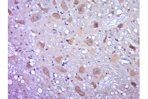 Paraformaldehyde-fixed, paraffin embedded rat brain, Antigen retrieval by boiling in sodium citrate buffer (pH6. (OGFOD2 antibody  (AA 101-200))