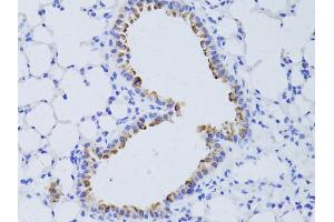 Immunohistochemistry of paraffin-embedded mouse lung using AQP4 antibody. (Aquaporin 4 antibody)