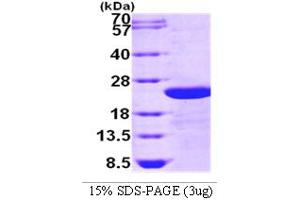 SDS-PAGE (SDS) image for Transforming Growth Factor, beta-Induced, 68kDa (TGFBI) (AA 502-683) protein (ABIN666732)