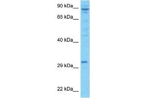 Host:  Rabbit  Target Name:  LRC52  Sample Type:  ACHN Whole Cell lysates  Antibody Dilution:  1. (LRRC52 antibody  (Middle Region))