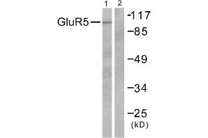 Western blot analysis of extracts from mouse brain, using GluR5 antibody (ABIN5976412). (GRIK1 antibody  (N-Term))