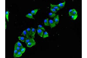 Immunofluorescent analysis of HepG2 cells using ABIN7152346 at dilution of 1:100 and Alexa Fluor 488-congugated AffiniPure Goat Anti-Rabbit IgG(H+L)