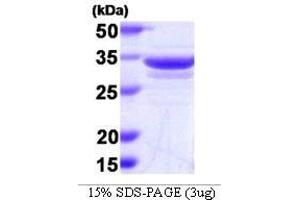 Figure annotation denotes ug of protein loaded and % gel used. (Annexin a1 Protein (AA 1-346))
