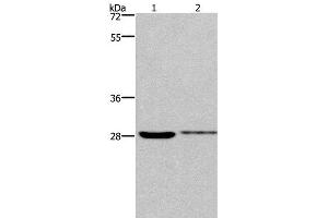 Western Blot analysis of 231 and Hela cell using CDK1 Polyclonal Antibody at dilution of 1:300 (CDK1 antibody)