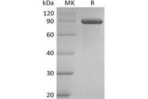 Western Blotting (WB) image for delta-Like 1 (DLL1) protein (Fc Tag) (ABIN7319919) (DLL1 Protein (Fc Tag))