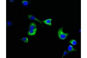Immunofluorescence staining of MCF-7 cells with ABIN7161807 at 1:133, counter-stained with DAPI. (NUMA1 antibody  (AA 627-870))