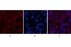 Immunofluorescence analysis of human appendix tissue. (MICU1 antibody)