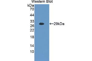 Figure. (MYLK2 antibody  (AA 330-548))