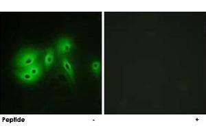 Immunofluorescence analysis of A-549 cells, using ADCY8 polyclonal antibody . (ADCY8 antibody)