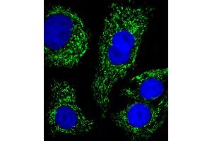 Fluorescent image of SK-BR-3 cells stained with ATP5B Antibody . (ATP5B antibody  (AA 135-163))