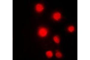 Immunofluorescent analysis of HMGB2 staining in Hela cells. (HMGB2 antibody)