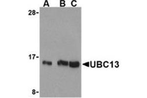 Western blot analysis of UBC13 in human small intestine cell lysates with this product at (A) 0. (UBE2N antibody  (C-Term))