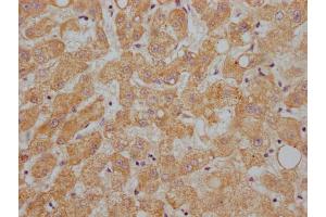 IHC image of ABIN7144415 diluted at 1:200 and staining in paraffin-embedded human liver tissue performed on a Leica BondTM system. (APOC1 antibody  (AA 35-48))