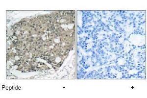 Image no. 1 for anti-V-Akt Murine Thymoma Viral Oncogene Homolog 1 (AKT1) (Thr308) antibody (ABIN197194)