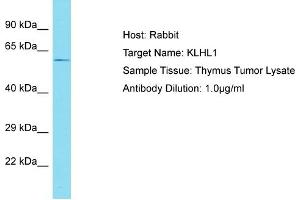 Host: Rabbit Target Name: KLHL1 Sample Tissue: Human Thymus Tumor Antibody Dilution: 1ug/ml