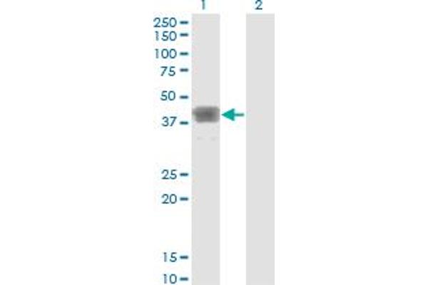 MAGEB1 antibody  (AA 1-347)