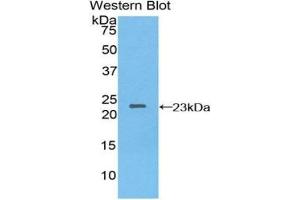 Detection of Recombinant NME3, Human using Polyclonal Antibody to Non Metastatic Cells 3, Protein NM23A Expressed In (NME3) (NME3 antibody  (AA 1-168))