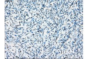 Immunohistochemical staining of paraffin-embedded colon tissue using anti-CRYABmouse monoclonal antibody. (CRYAB antibody)