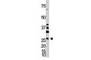 The DKK4 polyclonal antibody  is used in Western blot to detect DKK4 in A-375 cell lysate. (DKK4 antibody  (AA 162-189))