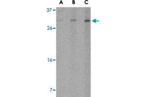 Western blot analysis of ORAI2 in Jurkat cell lysate with ORAI2 polyclonal antibody  at (A) 1, (B) 2 and (C) 4 ug/mL . (ORAI2 antibody  (C-Term))