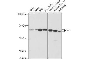 Western blot analysis of extracts of various cell lines, using YY1 antibody (ABIN6128933, ABIN6150354, ABIN6150356 and ABIN6216742) at 1:1000 dilution. (YY1 antibody  (AA 1-200))