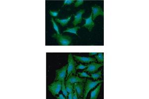 ICC/IF analysis of TBCA in A549 cells line, stained with DAPI (Blue) for nucleus staining and monoclonal anti-human TBCA antibody (1:100) with goat anti-mouse IgG-Alexa fluor 488 conjugate (Green). (TBCA antibody  (AA 1-108))