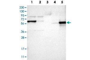 Western Blot analysis of Lane 1: RT-4 cell, Lane 2: U-251 MG sp cell, Lane 3: human plasma tissue (IgG/HSA depleted), Lane 4: human liver tissue and Lane 5: human tonsil tissue lysates with ICA1 polyclonal antibody .