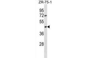Western Blotting (WB) image for anti-Olfactory Receptor, Family 2, Subfamily T, Member 6 (OR2T6) antibody (ABIN2998458)