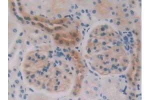 Detection of NOS2 in Rat Kidney Tissue using Polyclonal Antibody to Nitric Oxide Synthase 2, Inducible (NOS2) (NOS2 antibody  (AA 518-694))