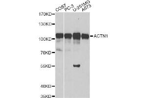 Western blot analysis of extracts of various cell lines, using ACTN1 antibody. (ACTN1 antibody)