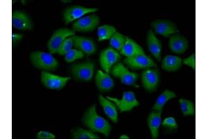 Immunofluorescence staining of A549 cells with ABIN7168014 at 1:66, counter-stained with DAPI. (RND1 antibody  (AA 1-106))