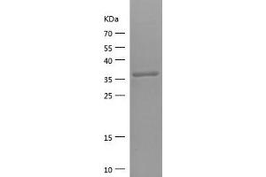 Western Blotting (WB) image for Solute Carrier Family 1 (Glial High Affinity Glutamate Transporter), Member 2 (SLC1A2) (AA 143-240) protein (His-IF2DI Tag) (ABIN7282187) (SLC1A2 Protein (AA 143-240) (His-IF2DI Tag))