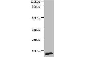 Western blot All lanes: TNNC2 antibody at 10 μg/mL + Mouse skeletal muscle tissue Secondary Goat polyclonal to rabbit IgG at 1/10000 dilution Predicted band size: 18 kDa Observed band size: 18 kDa (TNNC2 antibody  (AA 1-160))