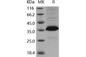 Western Blotting (WB) image for Follistatin-Like 3 (Secreted Glycoprotein) (FSTL3) (Active) protein (His tag) (ABIN7320428)