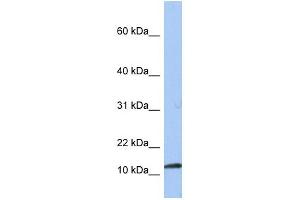 WB Suggested Anti-PEA15 Antibody Titration:  0. (PEA15 antibody  (Middle Region))