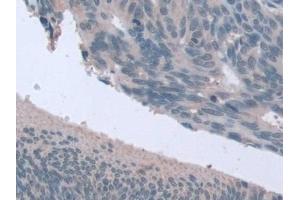 Immunohistochemistry (IHC) image for anti-Stress-Induced-phosphoprotein 1 (STIP1) (AA 1-169) antibody (ABIN7436411)