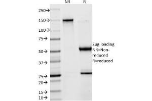 SDS-PAGE Analysis Purified Creatine Kinase-BB (CKBB) Mouse Monoclonal Antibody (2ba6). (CKB antibody)