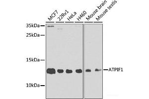 Western blot analysis of extracts of various cell lines using ATPIF1 Polyclonal Antibody at dilution of 1:1000. (ATPase Inhibitory Factor 1 antibody)