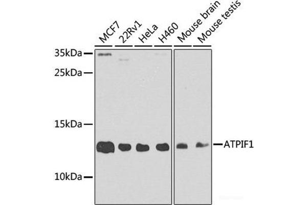 ATPase Inhibitory Factor 1 抗体