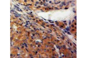 IHC-P analysis of Ovary tissue, with DAB staining. (FBLN2 antibody  (AA 858-1069))