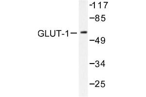 Image no. 1 for anti-Solute Carrier Family 2 (Facilitated Glucose Transporter), Member 1 (SLC2A1) antibody (ABIN265442) (GLUT1 antibody)