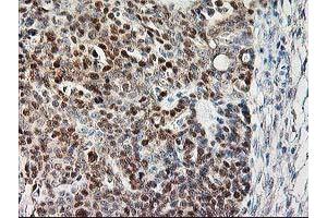 Image no. 2 for anti-Calpain 9 (CAPN9) antibody (ABIN1497092) (Calpain 9 antibody)