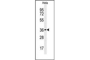 Western blot analysis of CTDSPL Antibody (N-term) in Hela cell line lysates (35ug/lane). (CTDSPL antibody  (N-Term))