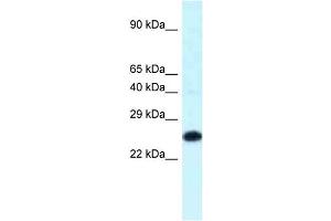 WB Suggested Anti-Hoxb9 Antibody Titration: 1.