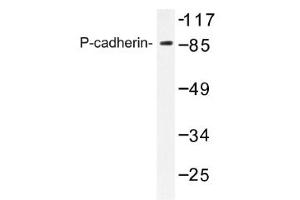 Image no. 1 for anti-P-Cadherin (CDH3) antibody (ABIN317619) (P-Cadherin antibody)