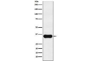 Western blot analysis of MC1 Receptor expression in A375 cell lysate.