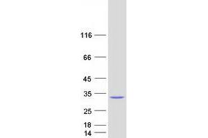 Western Blotting (WB) image for Glutathione S-Transferase alpha 5 (GSTa5) protein (Myc-DYKDDDDK Tag) (ABIN2722274)
